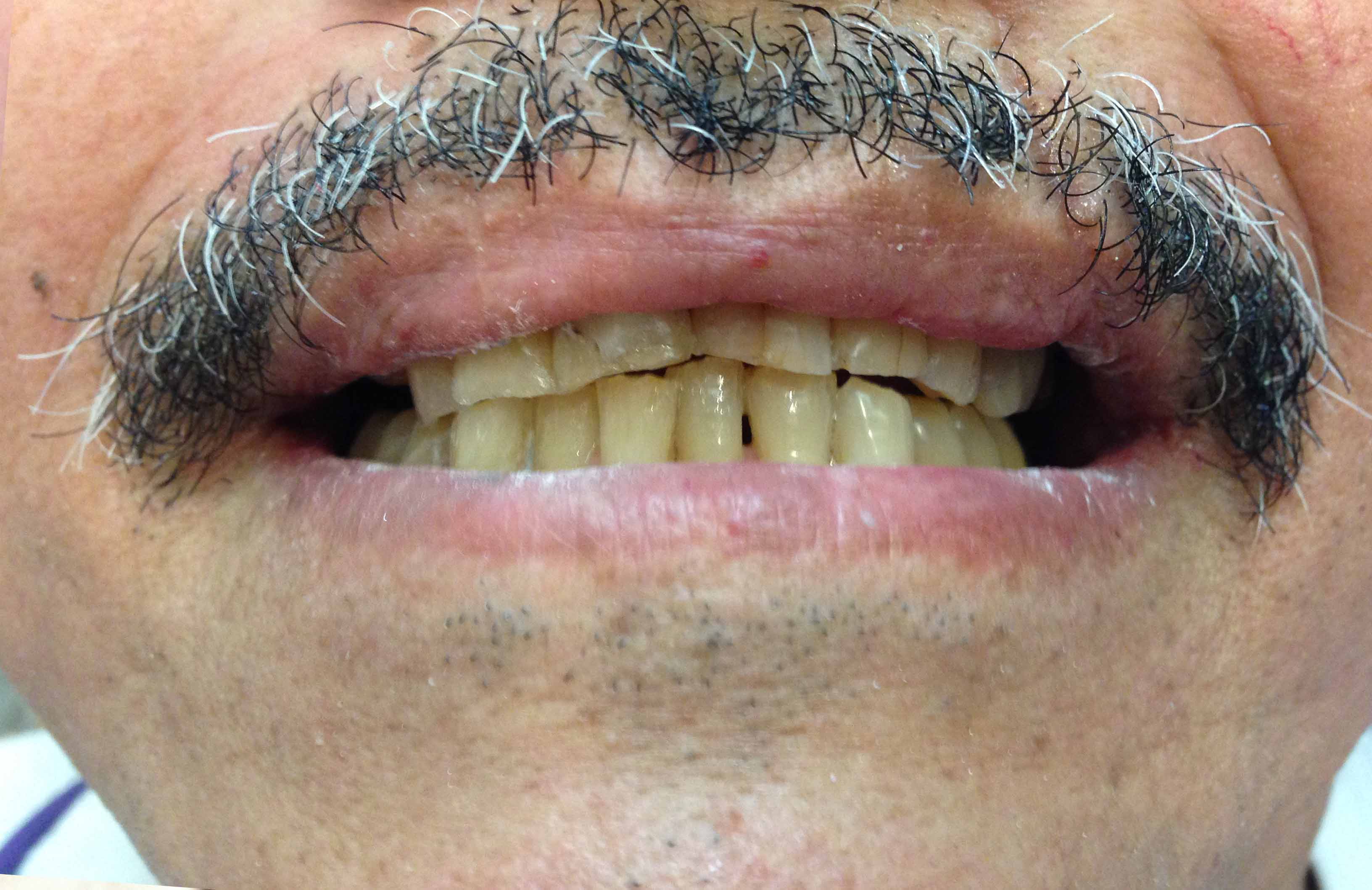 Colorado Springs Dentist Tuttle Family Dentistry